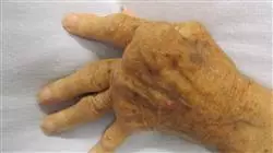 ##IMAGE##