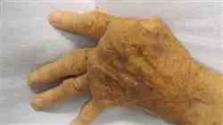 ##IMAGE##