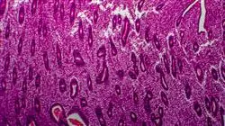 cursos evaluacion clinica diagnostico endometriosis