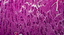 cursos tratamientos fertilidad endometriosis