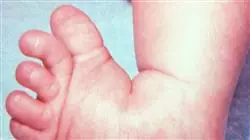 ##IMAGE##