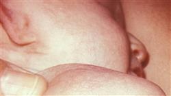 diplomado genetica clinica enfermedades pediatricas