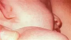 ##IMAGE##