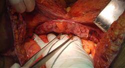 formacion cirugía bariátrica