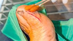 master semipresencial cirugia ortopedica traumatologia dos