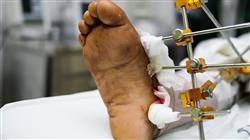 master semipresencial cirugia ortopedica traumatologia uno