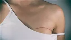 ##IMAGE##