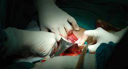 curso cirugía del colon