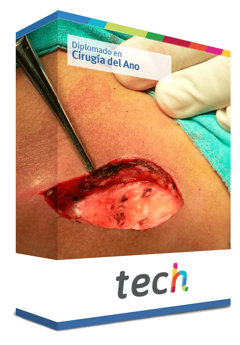 diplomado cirugia ano caja tech
