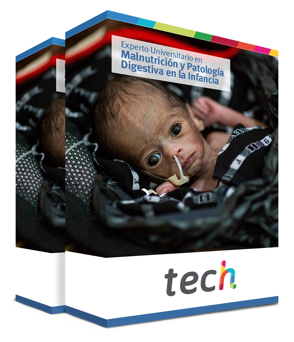 experto malnutricion patologia digestiva infancia tech caja