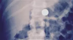 ##IMAGE##