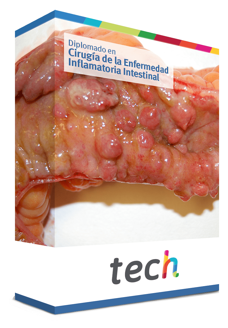 diplomado cirugia enfermedad inflamatoria intestinal caj