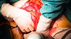 curso cirugia abdominall