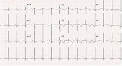 especializacion cardiología pediátrica no invasiva