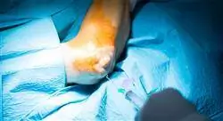 curso online cirugía ortopédica y traumatología de hombro y codo