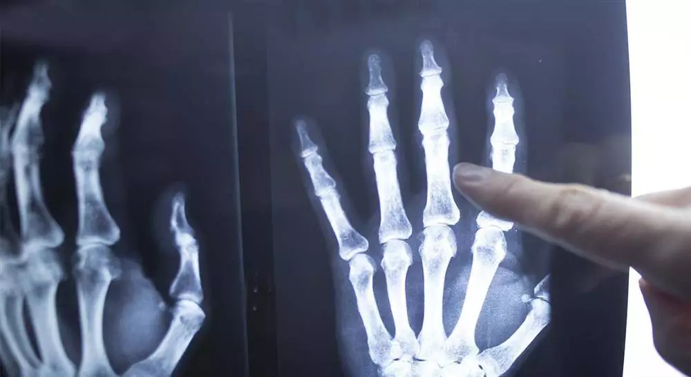 curso online cirugía ortopédica y traumatología de mano y antebrazo