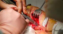 posgrado cirugía ortopédica y traumatología de mano y antebrazo