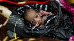 curso malnutricion infantil medicina