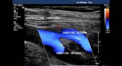 especializacion online ecografía clínica cerebral y vascular para emergencias y cuidados críticos