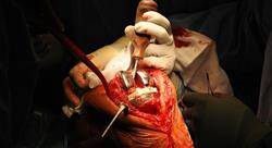 formacion cirugía ortopédica y traumatología de rodilla
