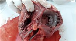 especializacion online el manejo global de la cardiotoxicidad en el paciente oncológico