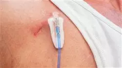 ##IMAGE##
