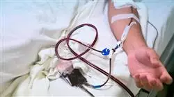 curso online transfusion pediatria