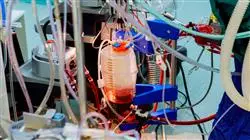 maestria medicina transfusional patient blood management