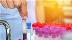 curso online avances enfermedades tropicales