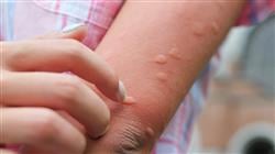 estudiar experto virus emergentes