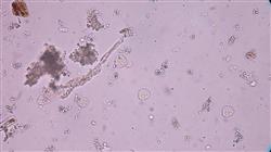 formacion parasitosis importadas
