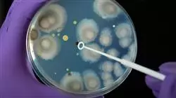 estudiar diagnostico bacteriologia micologia enfermedades importadas
