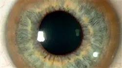 ##IMAGE##