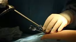 ##IMAGE##