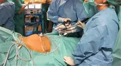 experto nuevas técnicas de cirugía mínimamente invasiva y robótica en ginecología