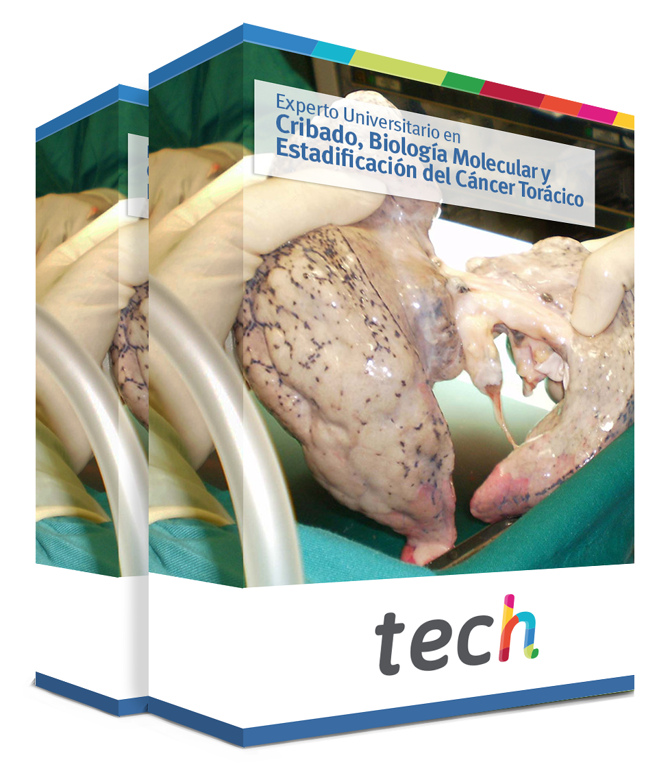 especializacion cribado biologia molecular estadificacion cancer toracico caja