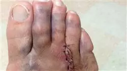 ##IMAGE##