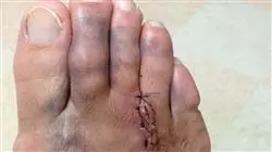 ##IMAGE##