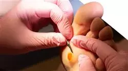 ##IMAGE##