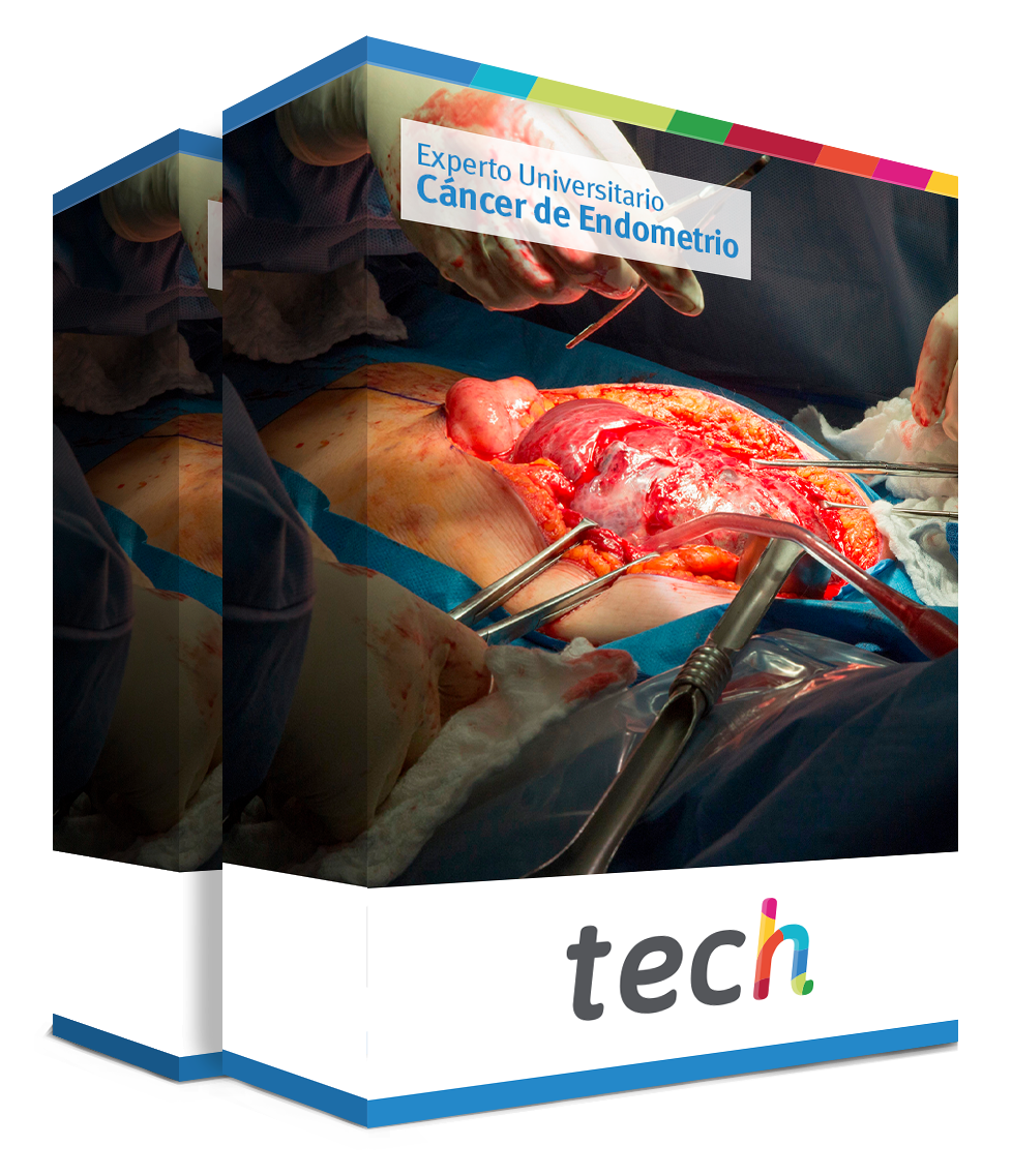 especializacion cancer endometrio caja