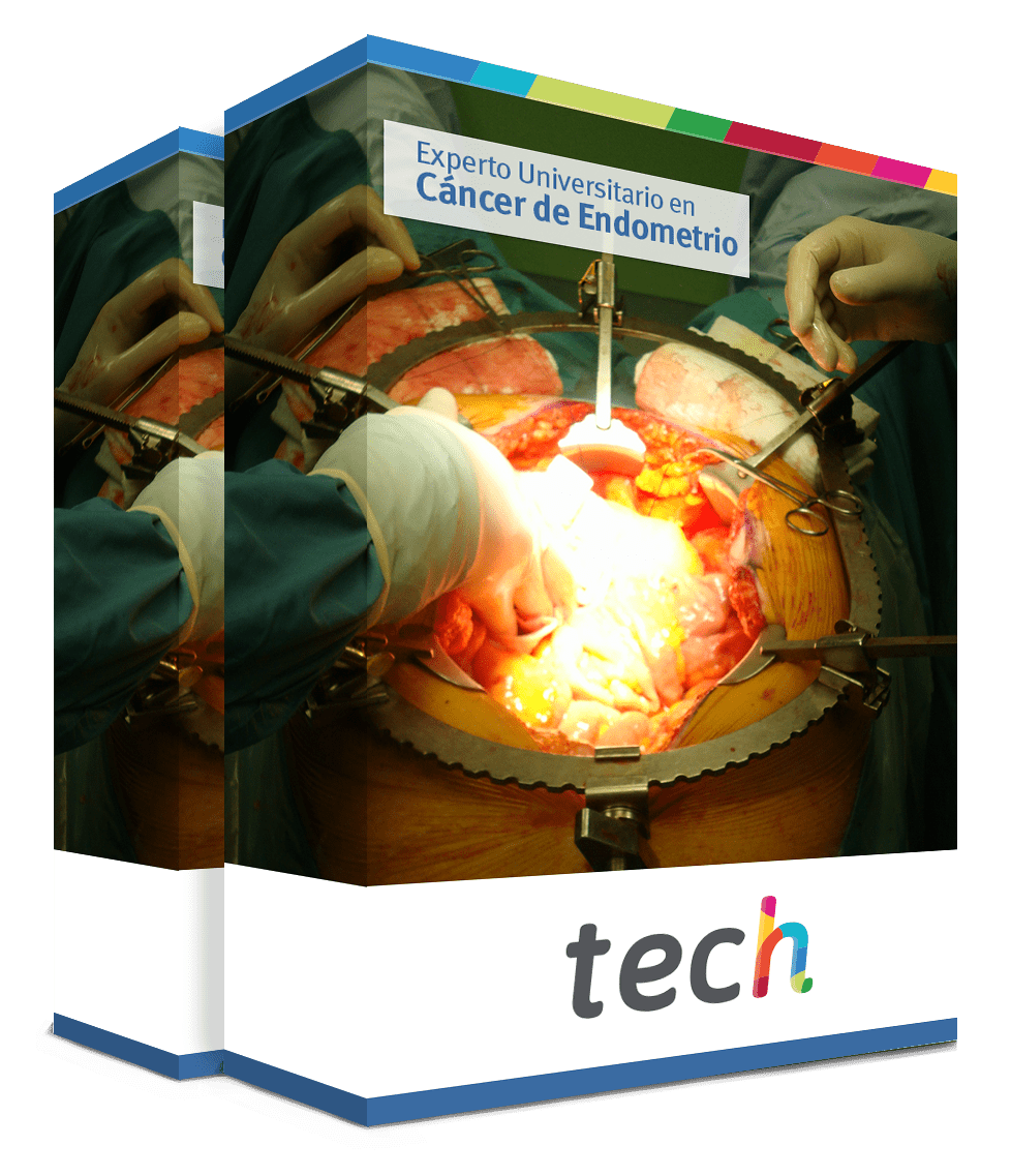 experto cancer endometrio tech caja