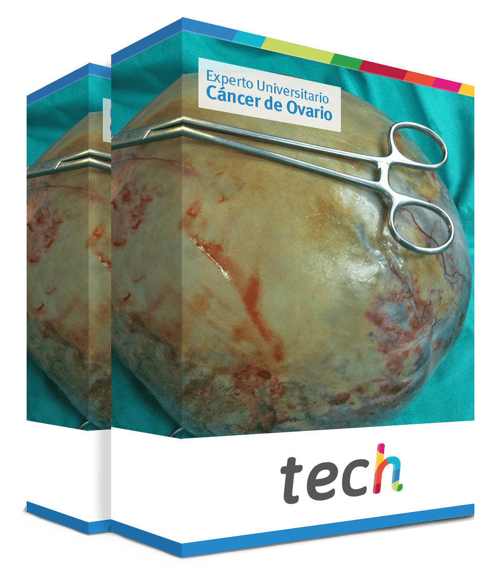 especializacion cancer ovario caja