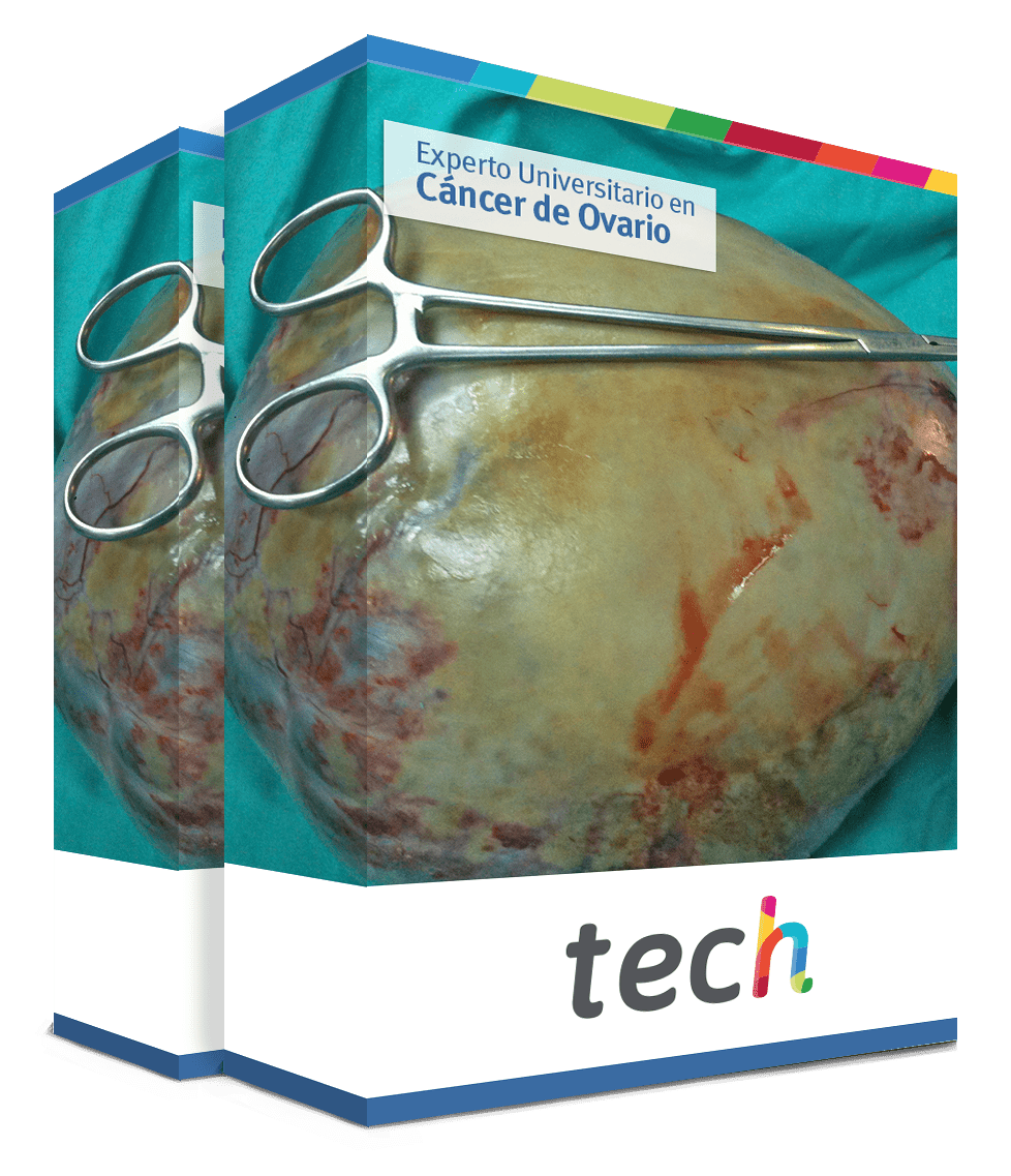 experto cancer ovario tech caja