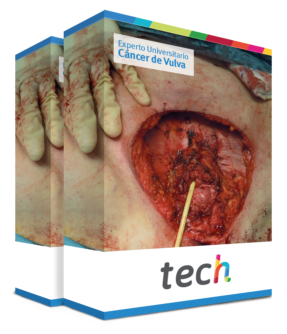 especializacion cancer vulva caja