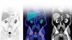 especializacion online medicina nuclear patologia adulto