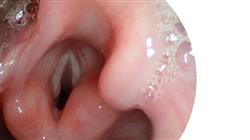 posgrado semipresencial terapia vocal medicina