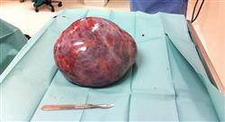 especializacion tumores ginecológicos infrecuentes