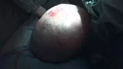 ##IMAGE##