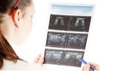 maestria oncologia endocrina