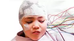 ##IMAGE##